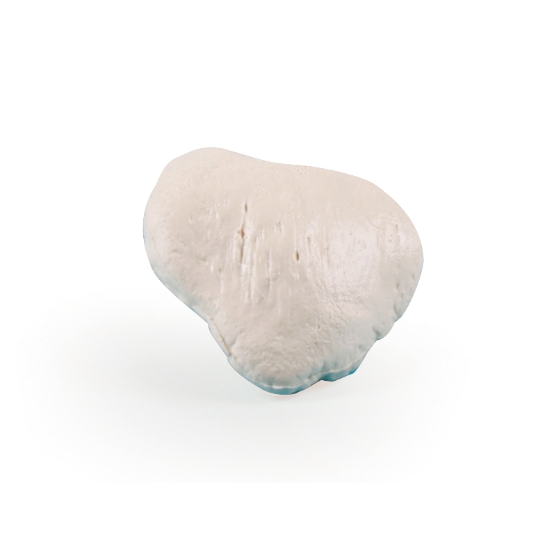 patella (kolenska čeljust)