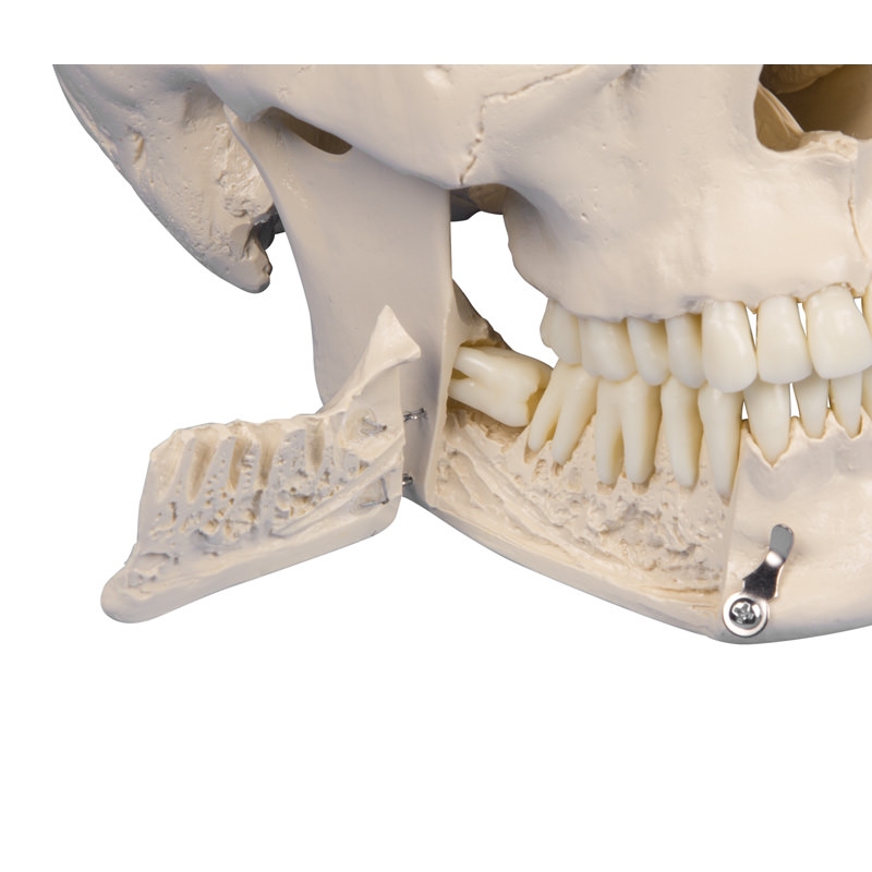 Zobna lobanja, 4-delna