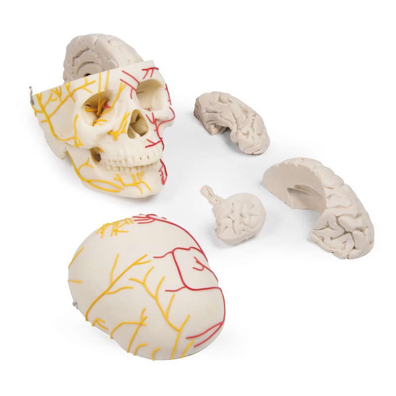 Nevrovaskularna lobanja z možgani