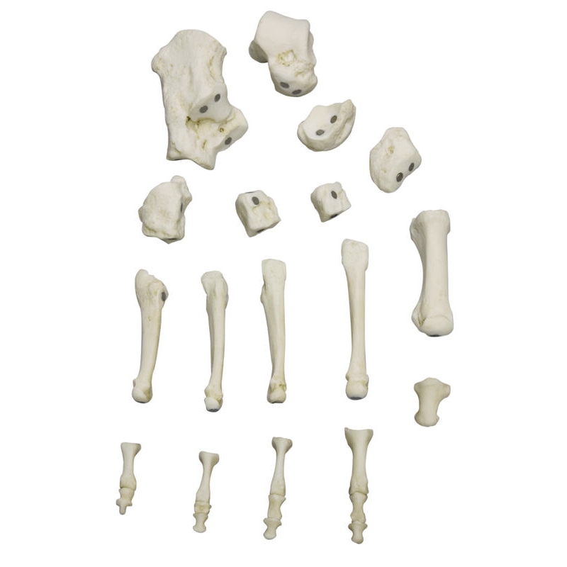 Človeško magnetno stopalo, desno