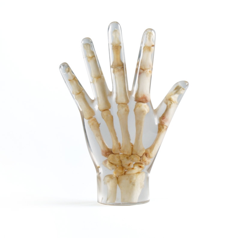 X-Ray Phantom Hand, prozoren