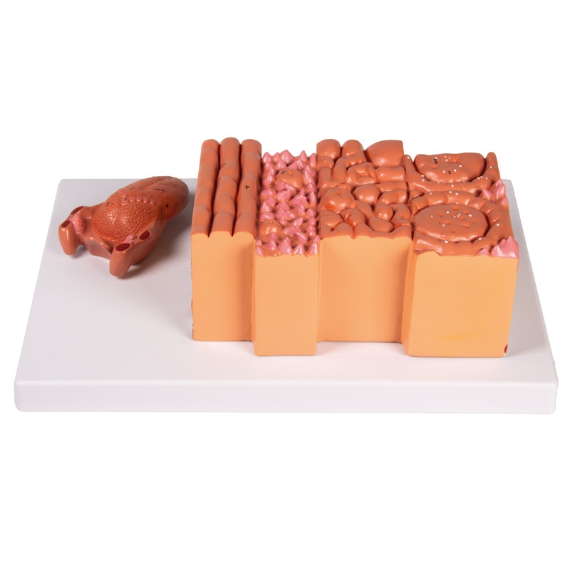 Jezik in tkivo jezika