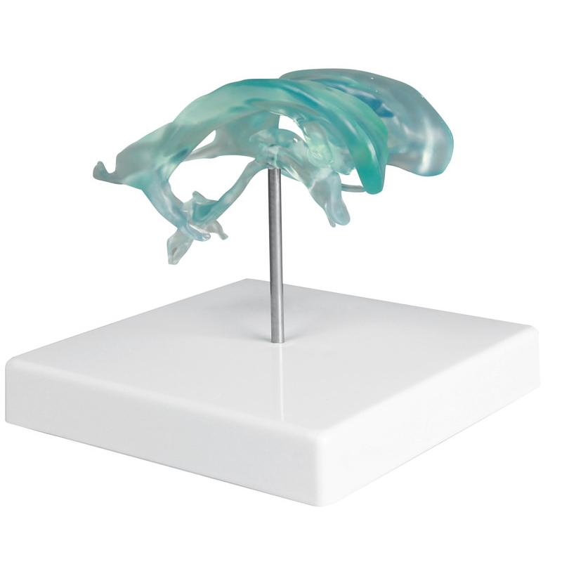  Možganski ventrikel