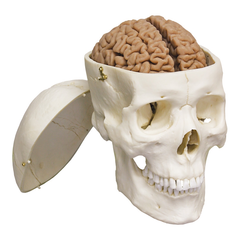 Človeški možgani, dejanski odlitek