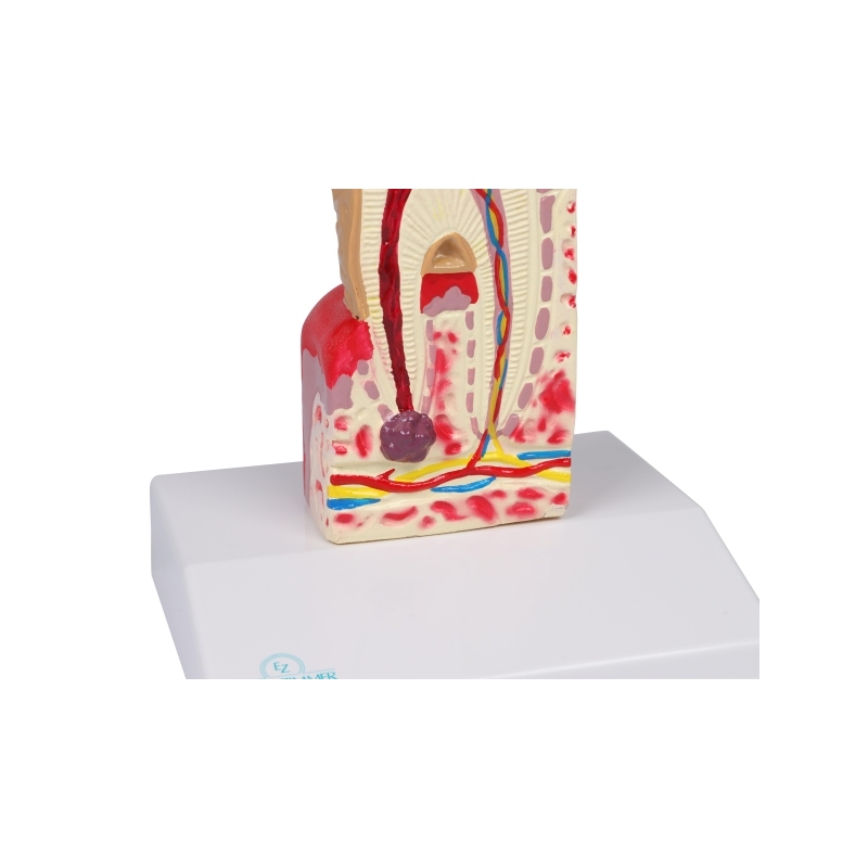 Model zobnega kariesa v 10-kratni naravni velikosti