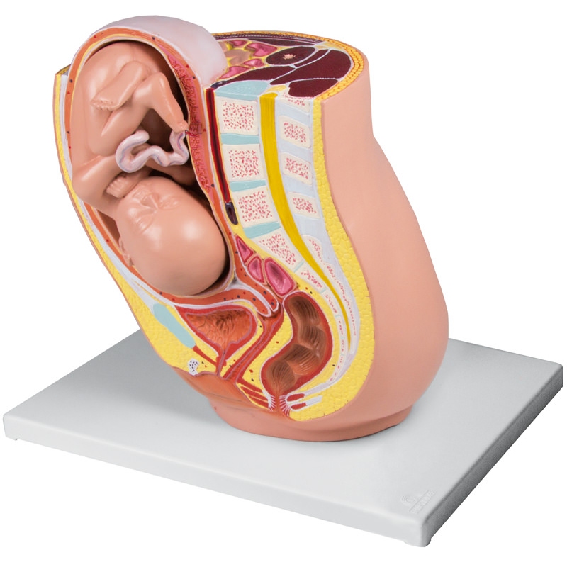 Nosečnost Medenica s plodom v 32. tednu nosečnosti, 2 dela