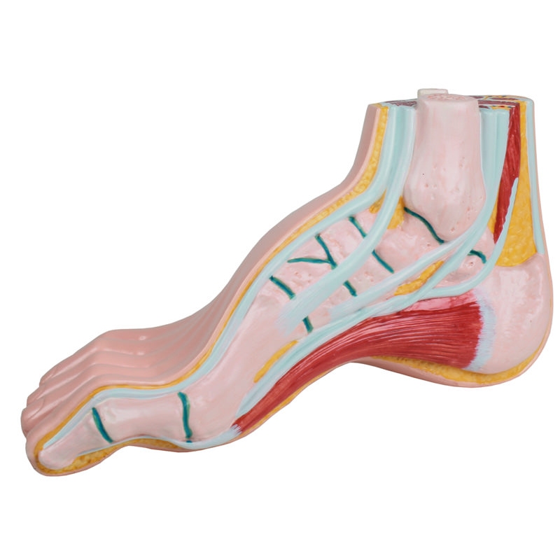 votlo stopalo, pes cavus