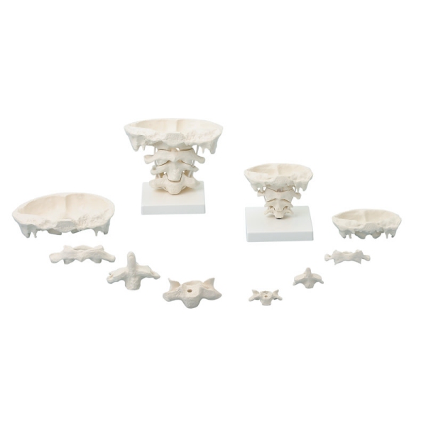 Artikulacije glave, 2 x povečava s stojalom