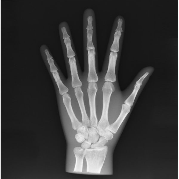 X-Ray Phantom Hand, prozoren
