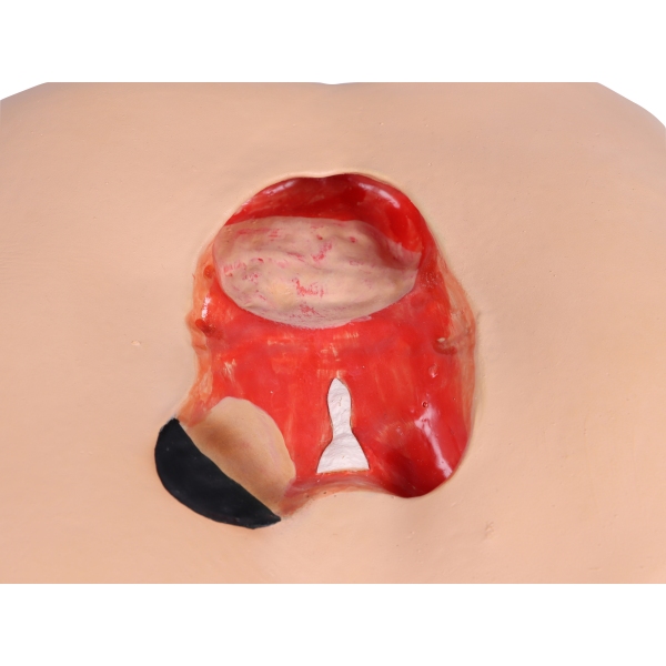 Dekubitus Dan" simulator oskrbe in previjanja