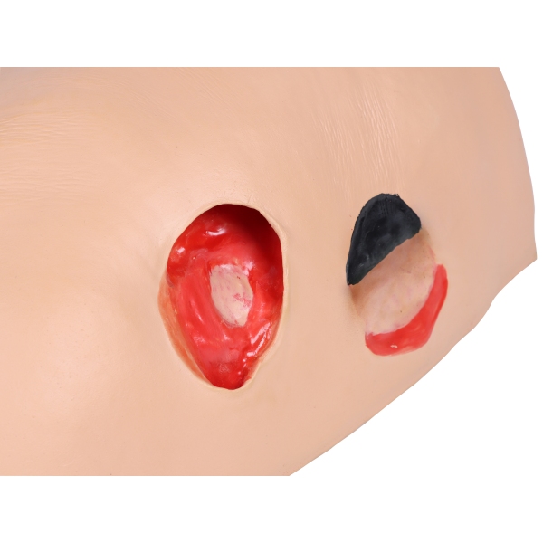 Dekubitus Dan" simulator oskrbe in previjanja