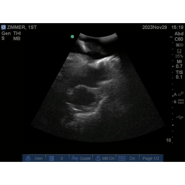 "Echo Eddie" Napredni simulator ultrazvočnega pregleda