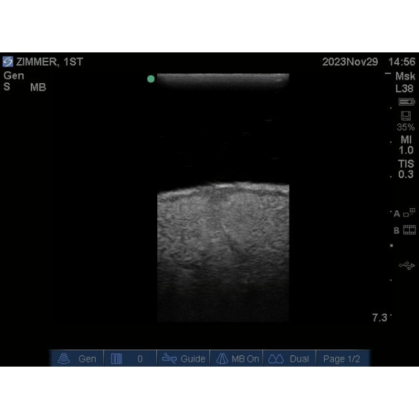 "Echo Eddie" Napredni simulator ultrazvočnega pregleda