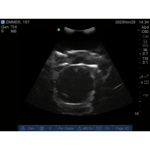 "Echo Eddie" Napredni simulator ultrazvočnega pregleda