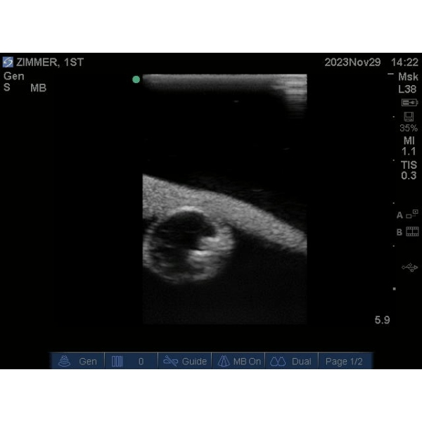 "Echo Eddie" Napredni simulator ultrazvočnega pregleda