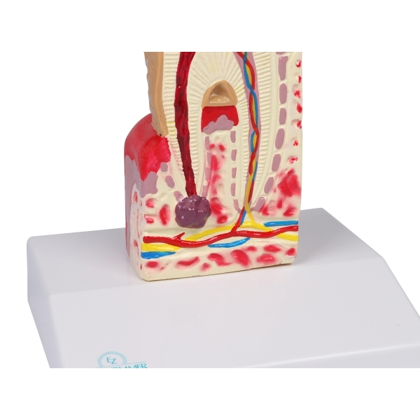 Model zobnega kariesa v 10-kratni naravni velikosti