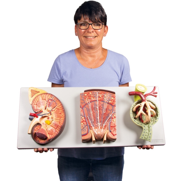 Razdelek ledvic z ledvičnim nefronom in ledvičnim telescem