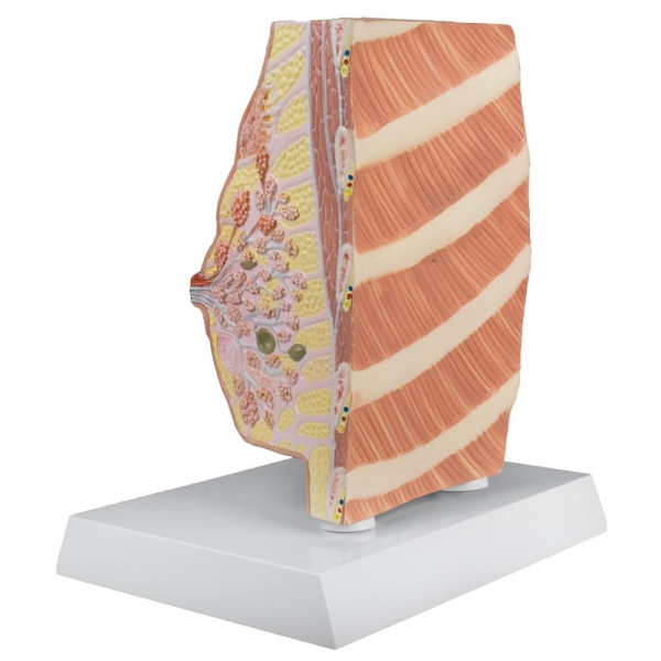 Prerez dojke z boleznimi