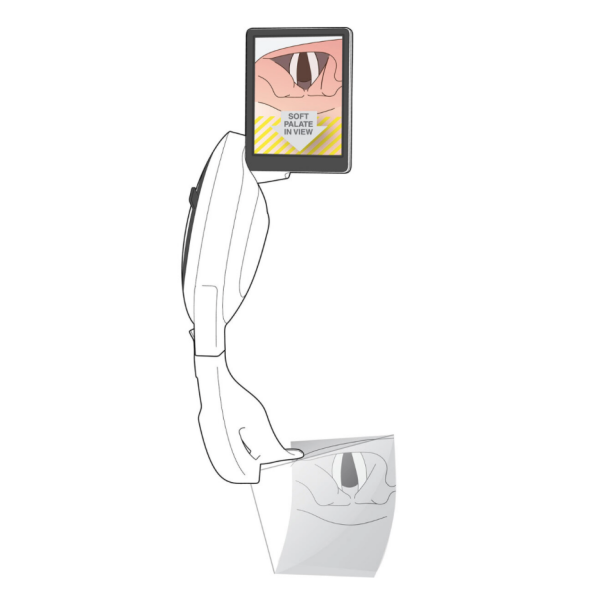 McGRATH MAC Video Laryngoskop Gen 3 (videolaringoskop)