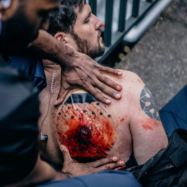 SAM CHEST SEAL Combo – obliž za pnevmotoraks (2 kom. – z ventilom in brez)