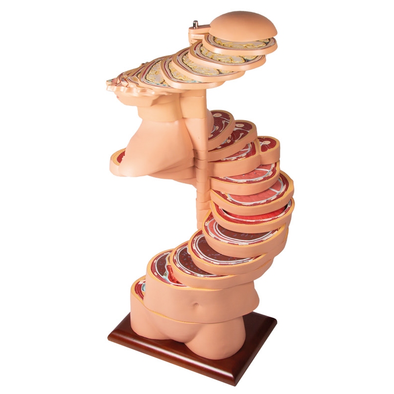 Torzo diska, naravna velikost