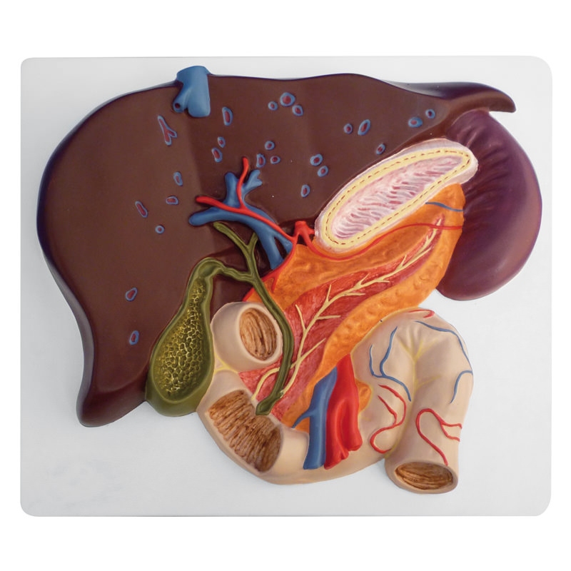 Jetra z žolčnikom, trebušno slinavko in dvanajstnikom