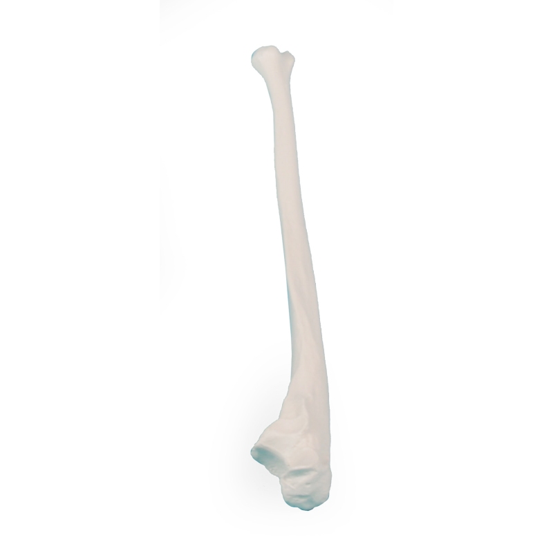 Ulna