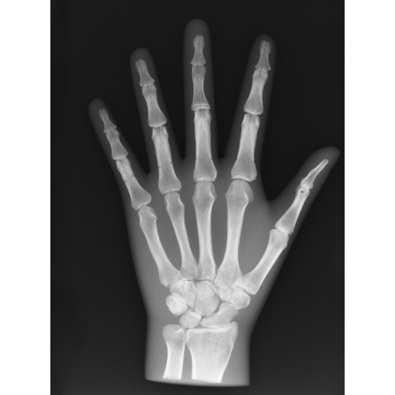 X-Ray Phantom Hand, neprozoren