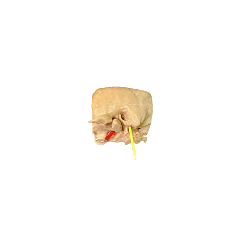 Petrous Bone