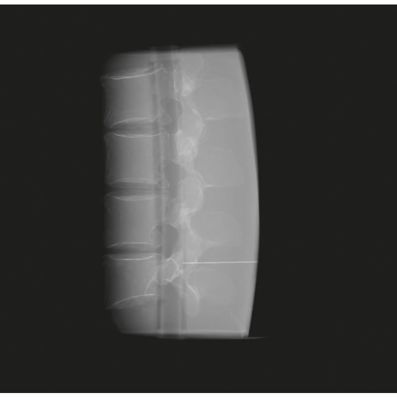 Fantom za usposabljanje za fluoroskopijo ledvene hrbtenice