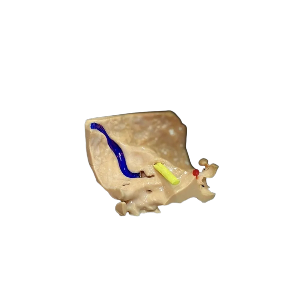 Petrous Bone